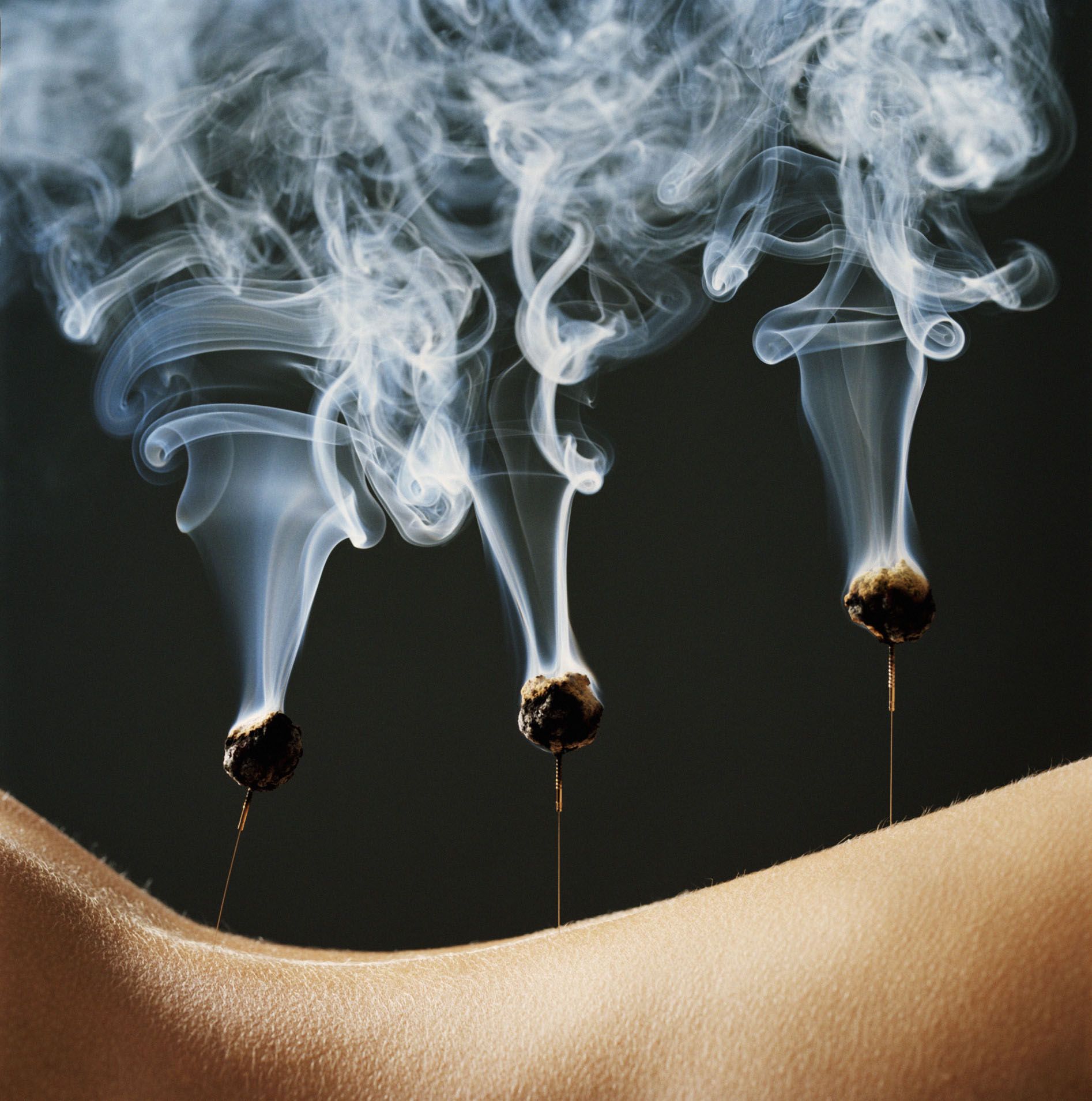 acupuncture.md