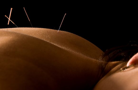 acupuncture.md