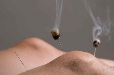 acupuncture.md