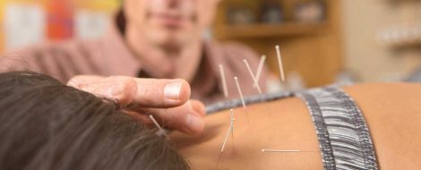 acupuncture.md