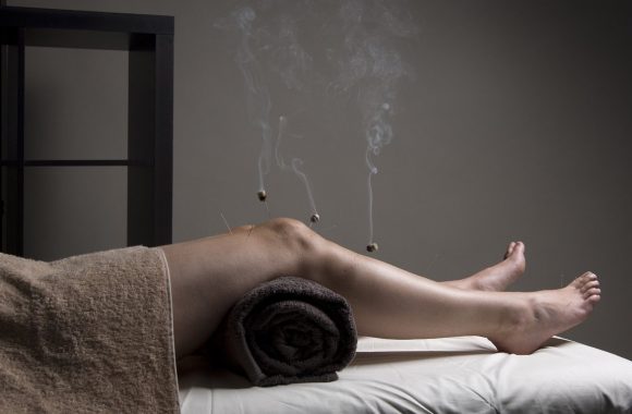 acupuncture.md