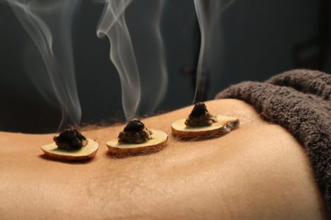 acupuncture.md