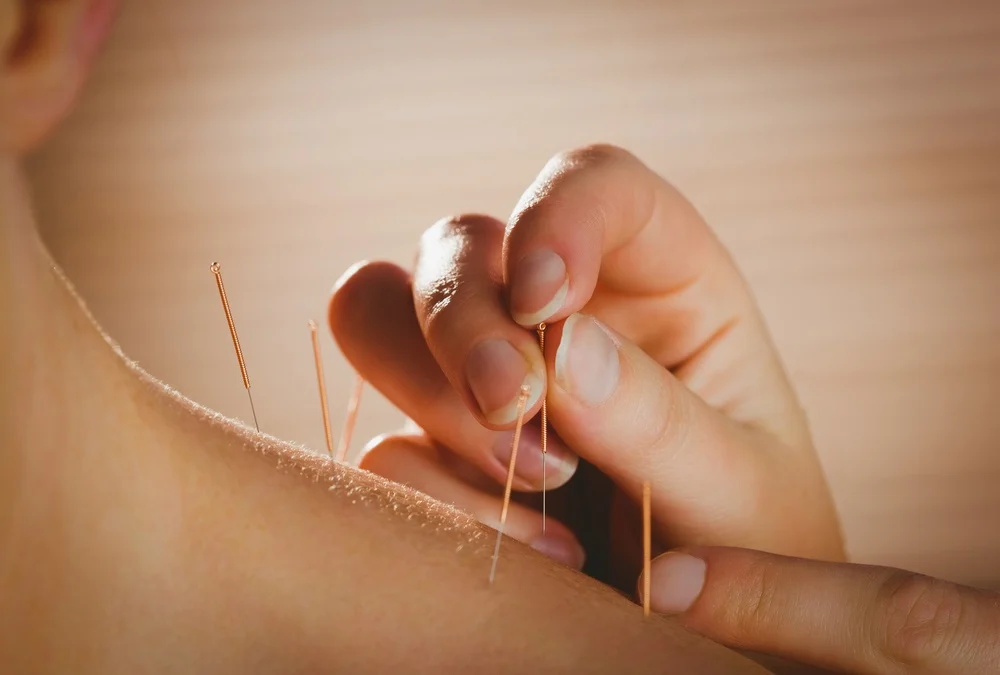 acupuncture.md