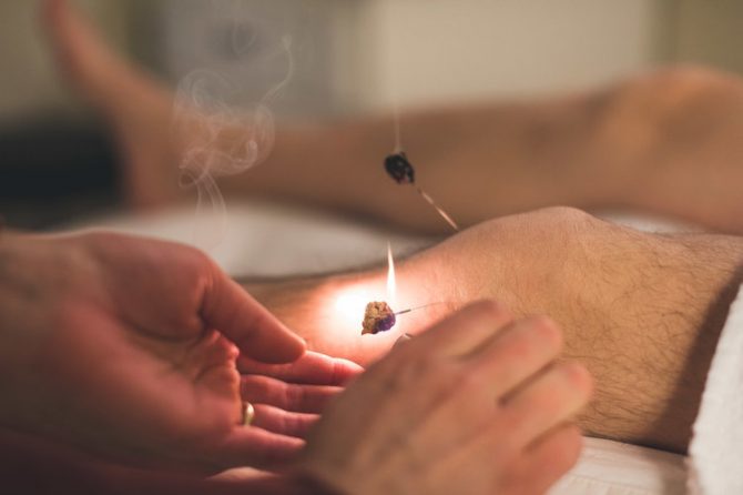 acupuncture.md